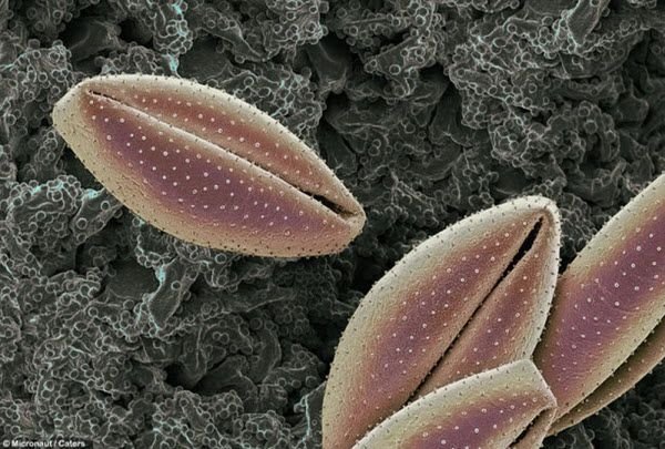 pollen allergies under microscope