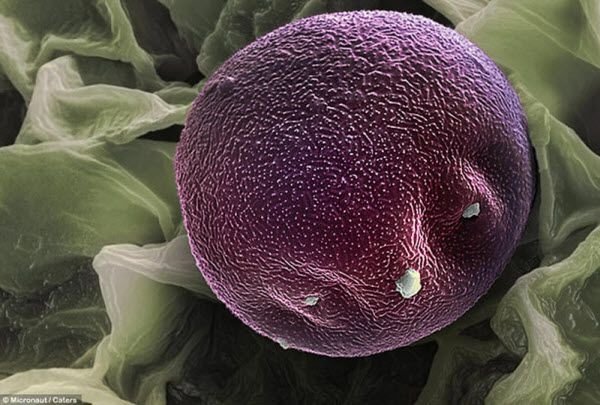 pollen allergies under microscope