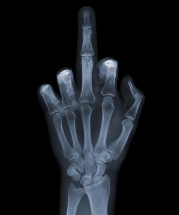 x-ray picture