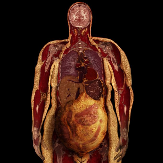 Body Voyage: A 3D Tour of a Real Human Body by Alexander Tsiaras