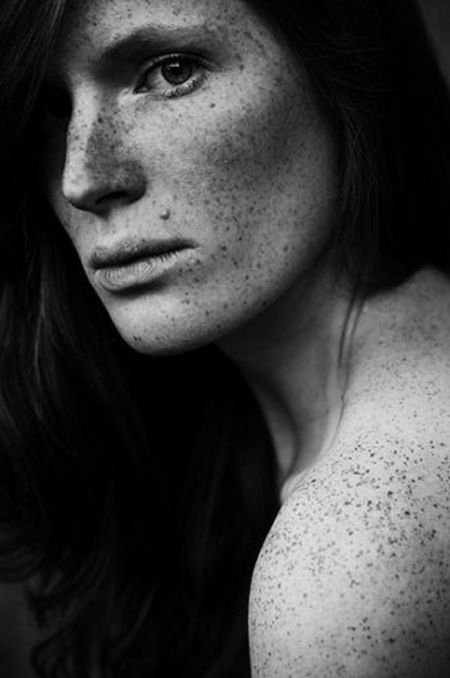 freckled girl