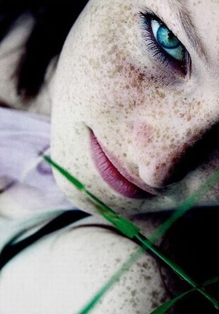 freckled girl