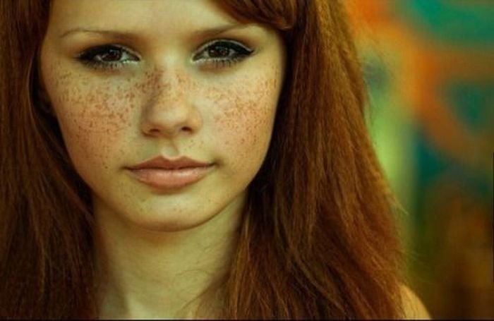 freckled girl